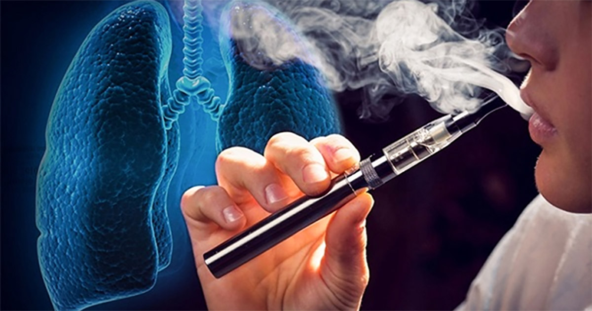 Thuốc lá điện tử có an toàn hơn thuốc lá truyền thống không? 9