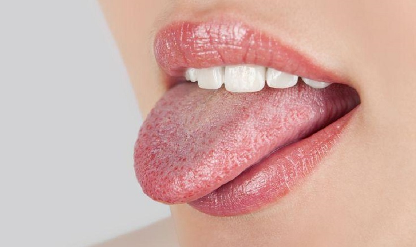 Lưỡi có Đốm Đỏ là bệnh gì? Cách Điều Trị và Phòng Ngừa hiệu quả 7