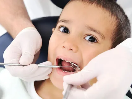 Bé 5 tuổi bị sâu răng hàm phải làm sao? 13