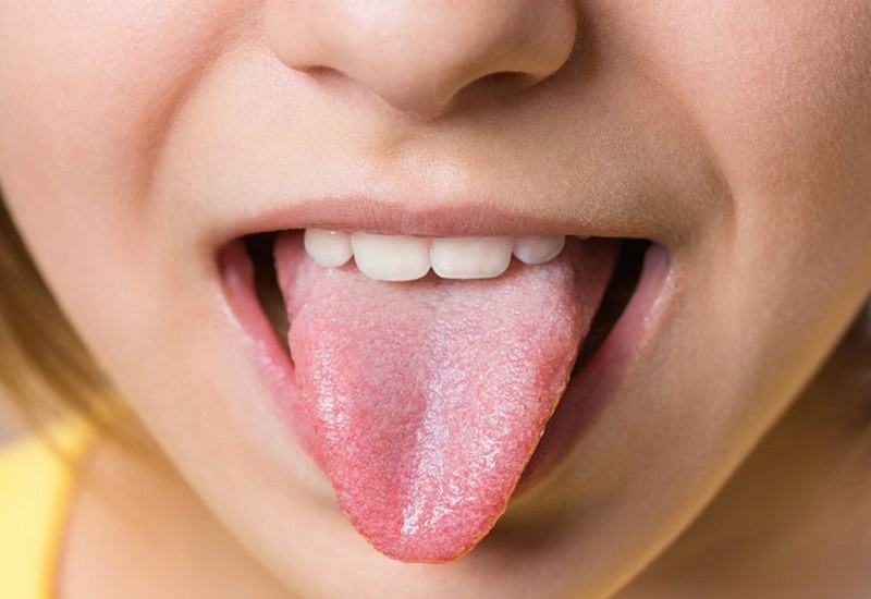 Lưỡi có Đốm Đỏ là bệnh gì? Cách Điều Trị và Phòng Ngừa hiệu quả 3