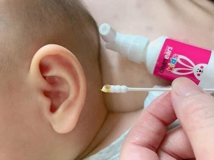 Có nên dùng xịt tan ráy tai cho bé không? 15
