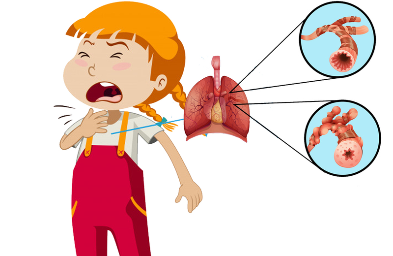 Những mẹo dân gian chữa viêm phổi cho trẻ có thể bạn chưa biết 9
