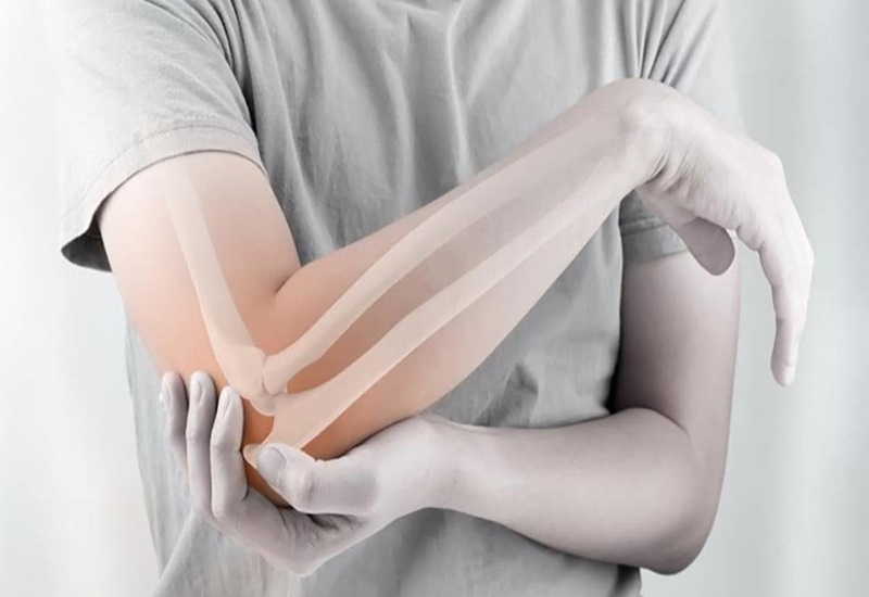 Gãy xương cẳng tay - Nguyên nhân, triệu chứng và cách điều trị 5