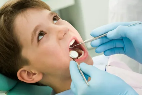 Bé 5 tuổi bị sâu răng hàm phải làm sao? 11